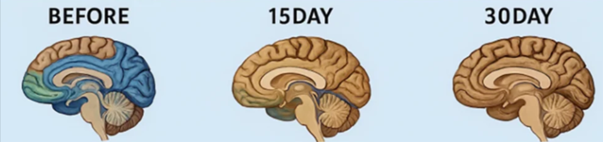 Memory Lift Benefits