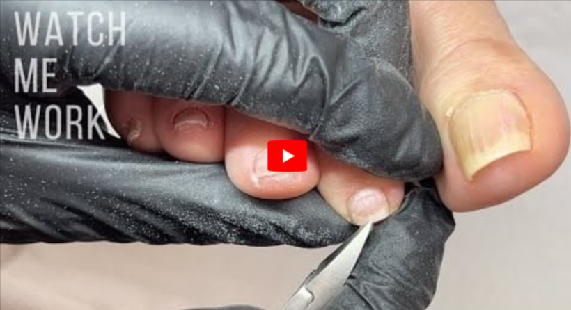 Ariella Toenail Fungus Nail Repair Pen