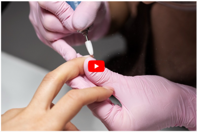 Bleach Pen for Toenail Fungu