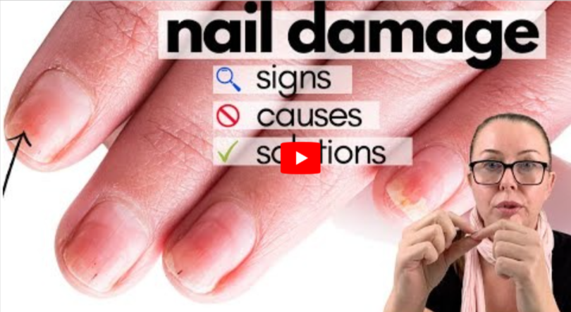 Clorox Pen for Toenail Fungus