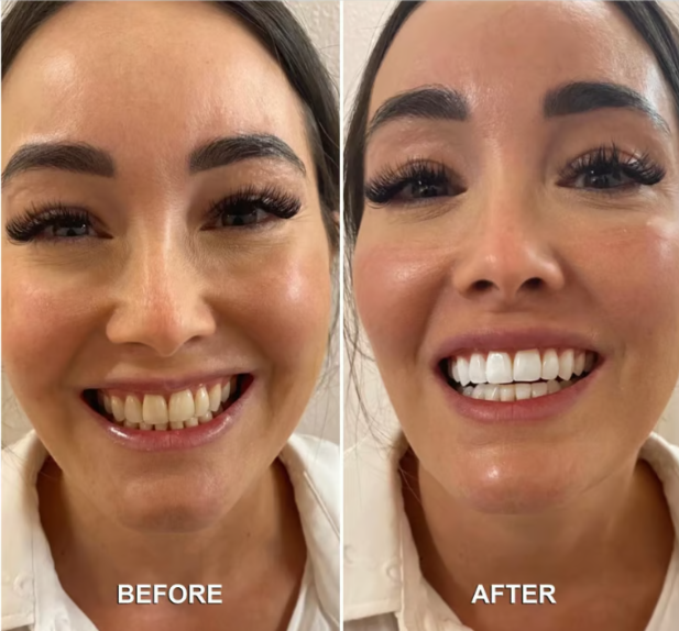 Denta Blast Benefits