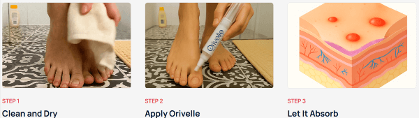 Orivelle Nail Fungus Pen use