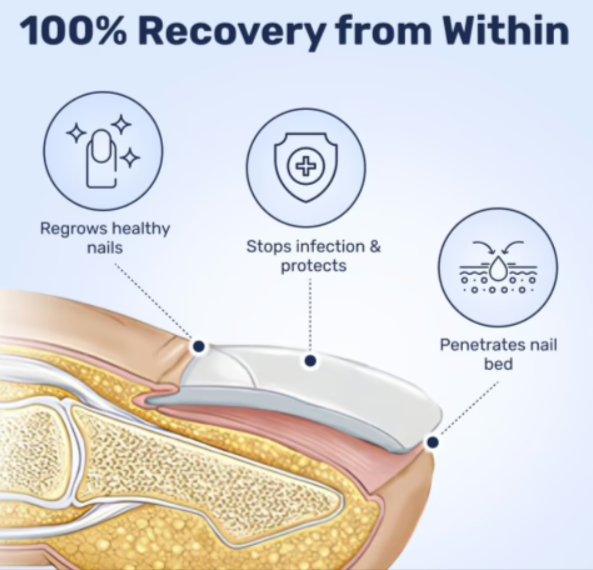 WellaNail Fungus Treatment Oil