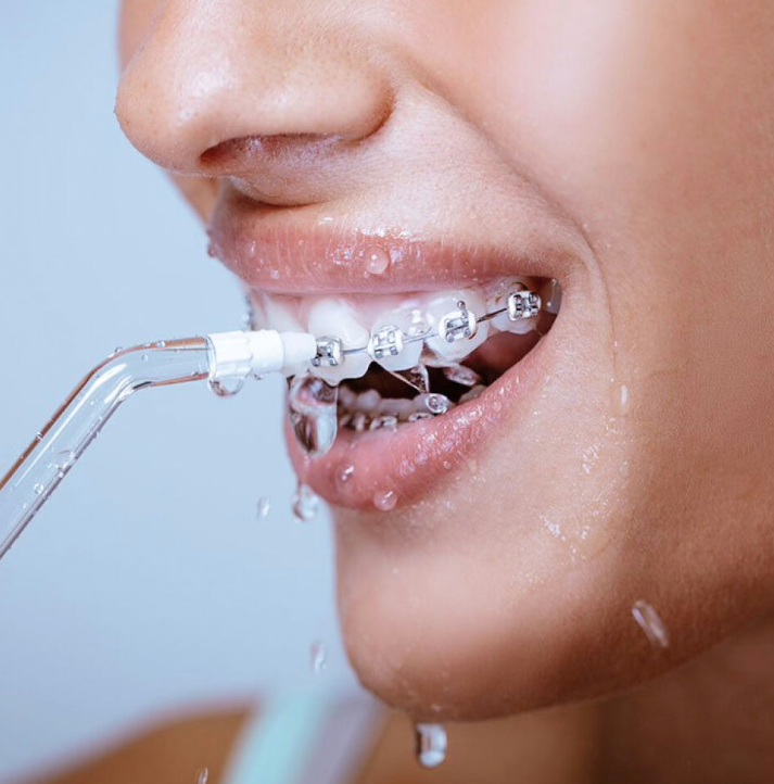 WellaWhite Water Flosser Benefits