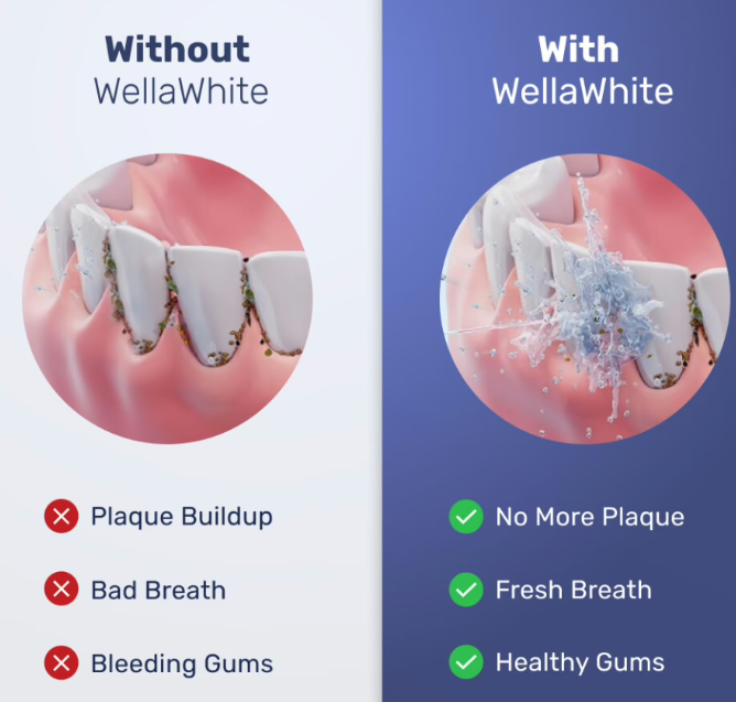 WellaWhite Water Flosser vs