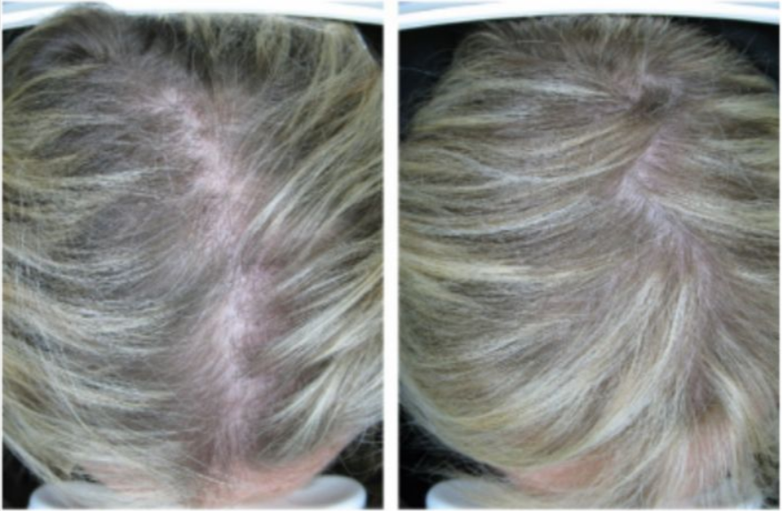 Purality Health Hair Renewal Benefits