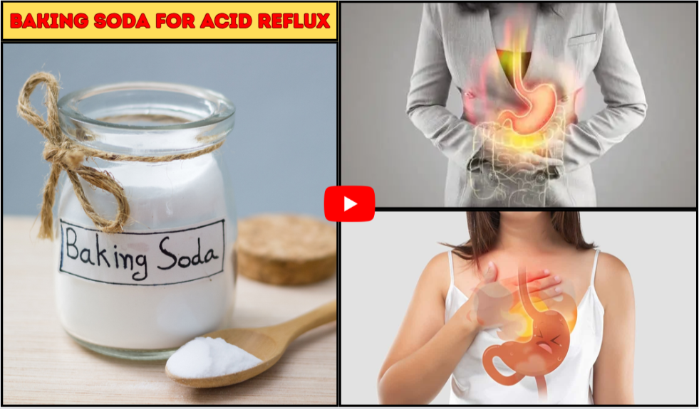 Baking Soda For Acid Reflux