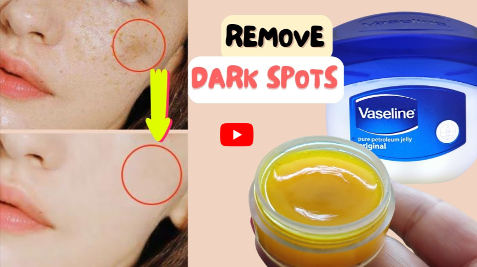 Baking Soda with Vaseline for DarkSpots