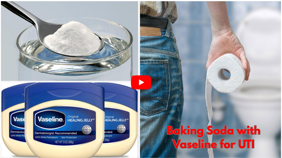 Baking Soda with Vaseline for UTI