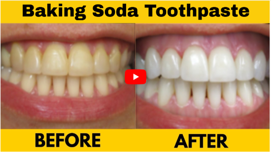 BakingSoda Toothpaste