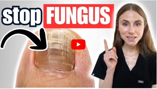 BestBleach Pen for Toenail Fungus