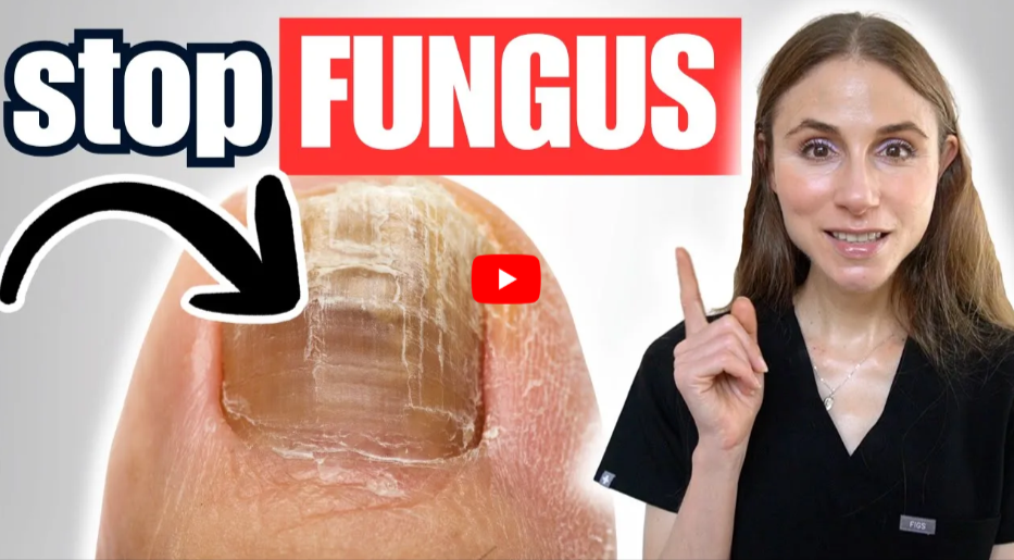 Biblical Cure For ToenailFungus