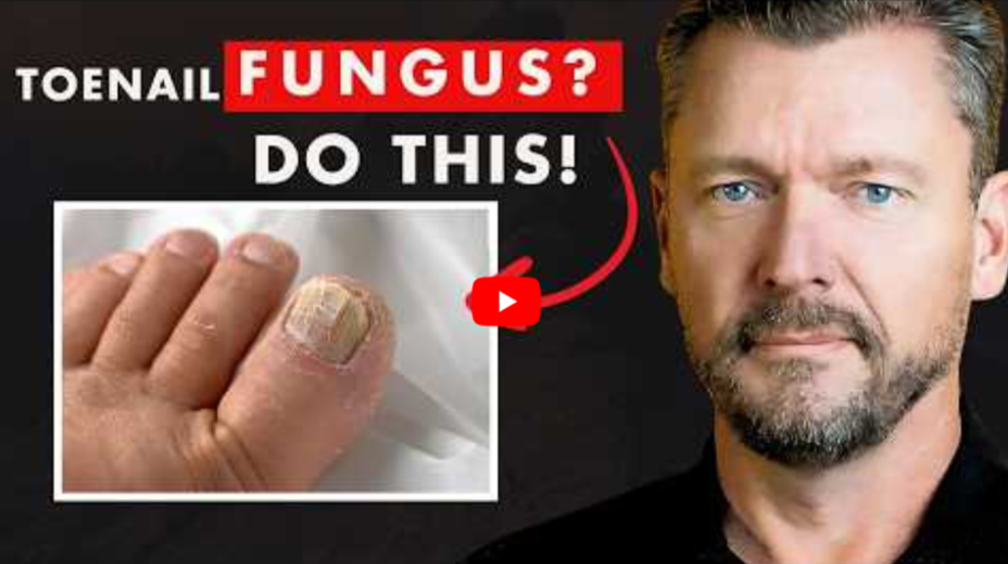 BiblicalCure For Toenail Fungus