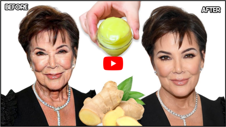 Ginger Trick For Wrinkles: Natural Anti-Aging Secret