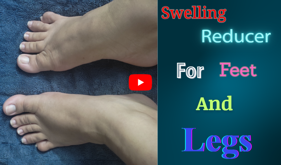 Swelling Reducer For Feet And Legs