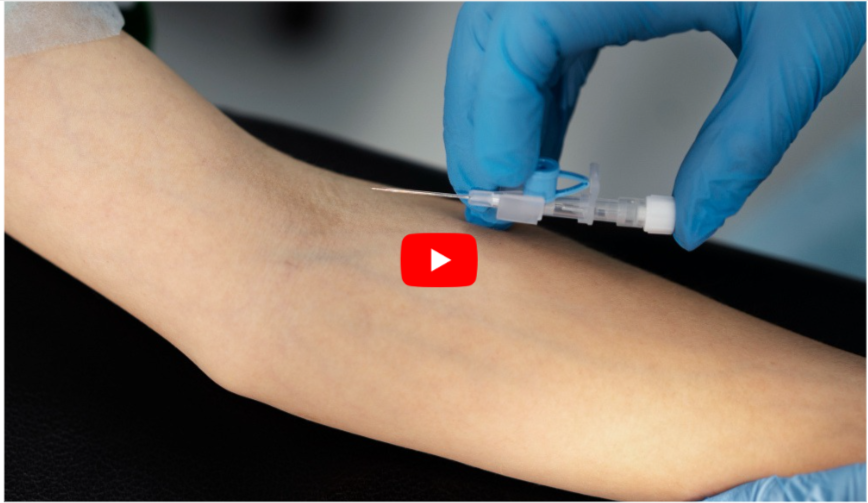 Varicose Vein Injections SideEffects