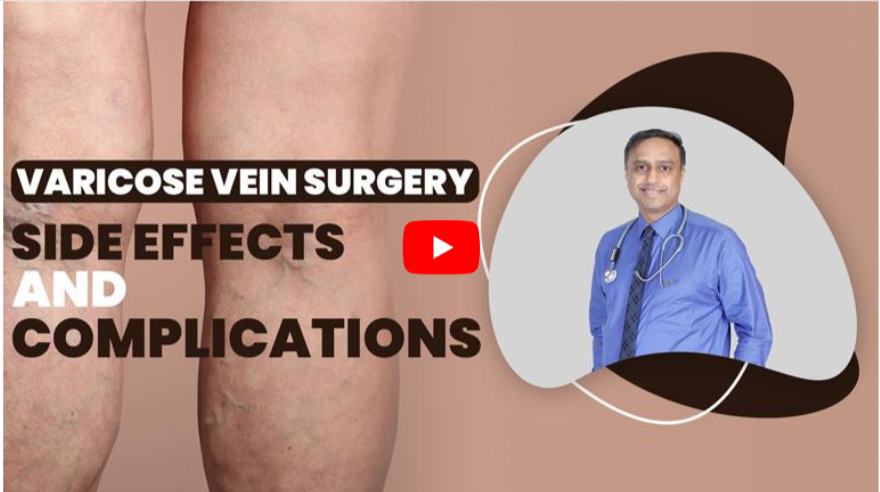 VaricoseVein Injections Side Effects