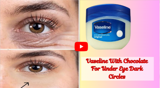 Vaseline With Chocolate For Under Eye Dark Circles