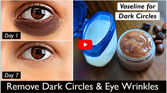 Vaseline With Chocolate For Under Eye DarkCircles