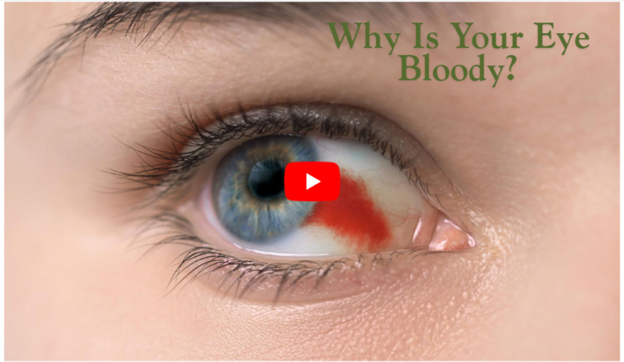 Why Is Your Eye Bloody