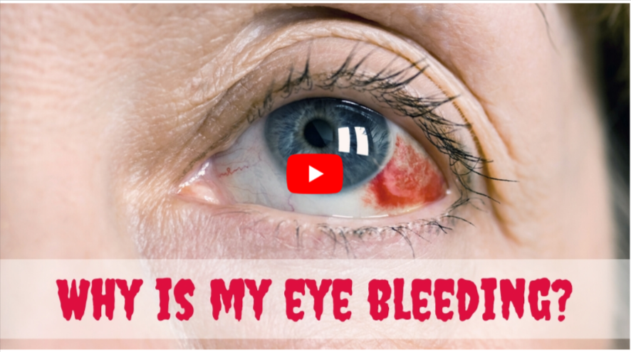 Why Is Your EyeBloody