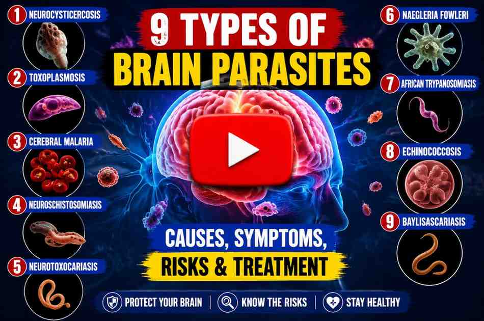 9 Types of BrainParasites