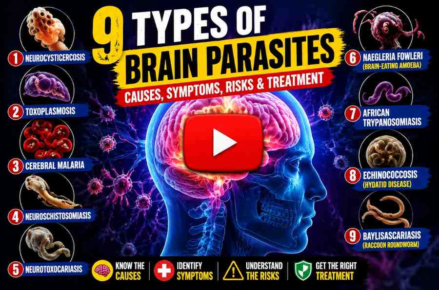 9Types of Brain Parasites 
