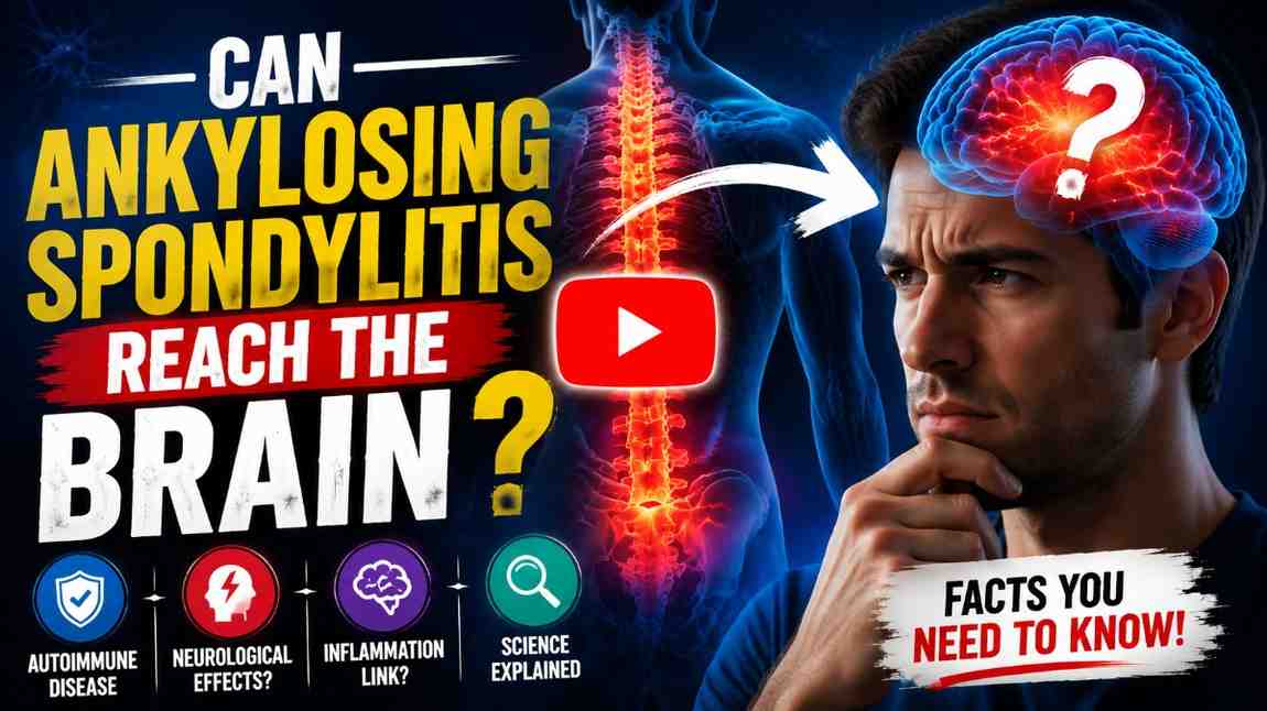 Does Ankylosing Spondylitis Affect the Brain reach the brain