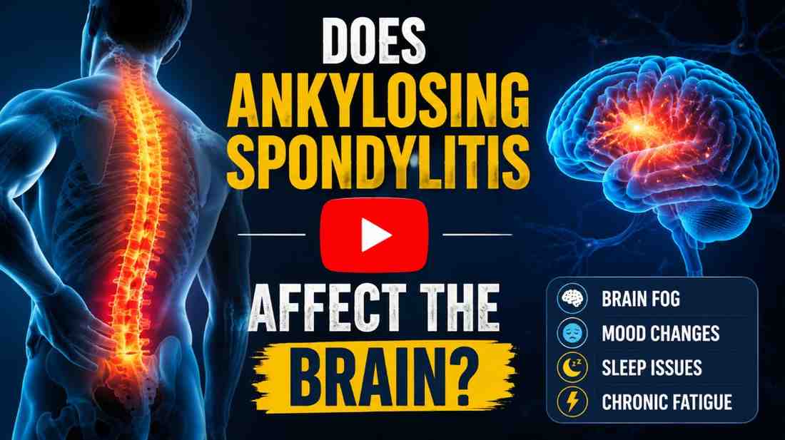 Does Ankylosing Spondylitis Affect the Brain