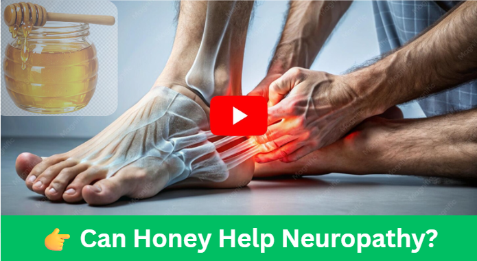 Neuropathy Honey Remedy