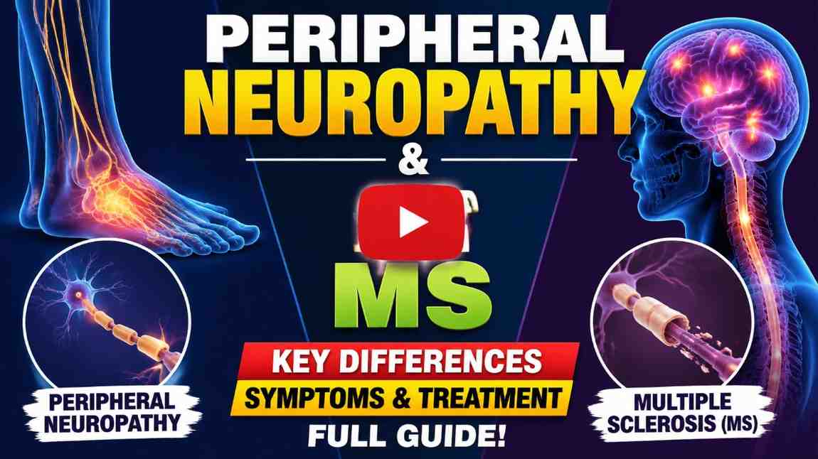 Peripheral-Neuropathy-and-MS