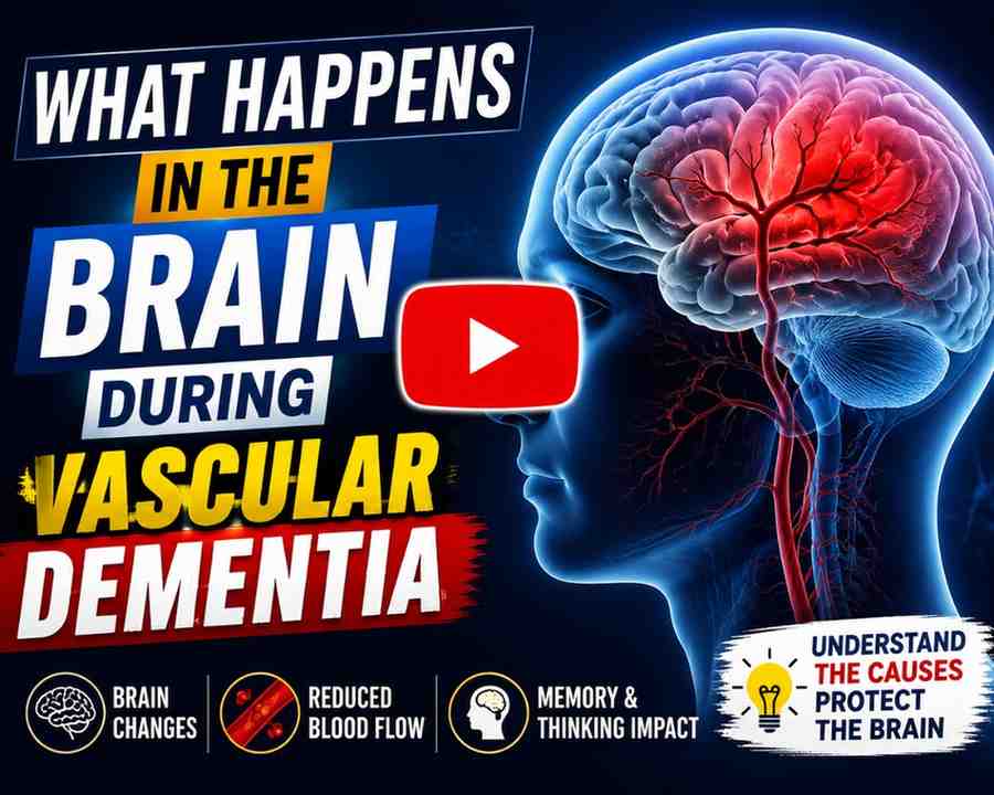 What Happens in the Brain During Vascular Dementia