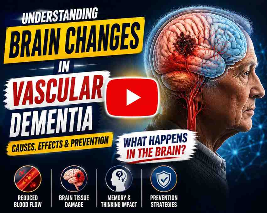 What Happens inthe Brain During Vascular Dementia