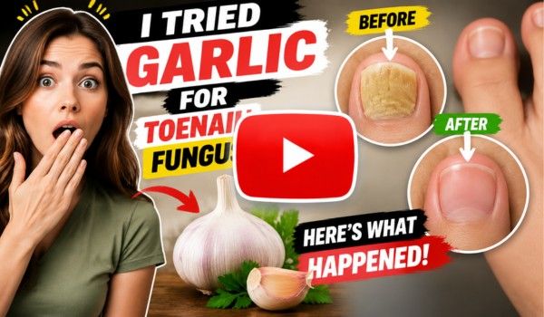 Garlic-Toe-Makeover-Thumbnail