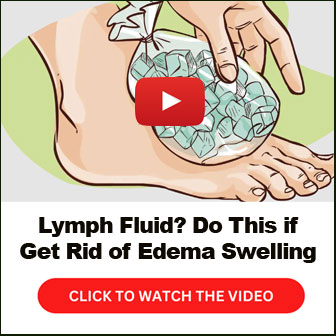 Lymph Fluid Do This if Get Rid of Edema Swelling
