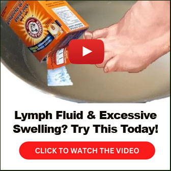 Lymph Fluid Excessive Swelling