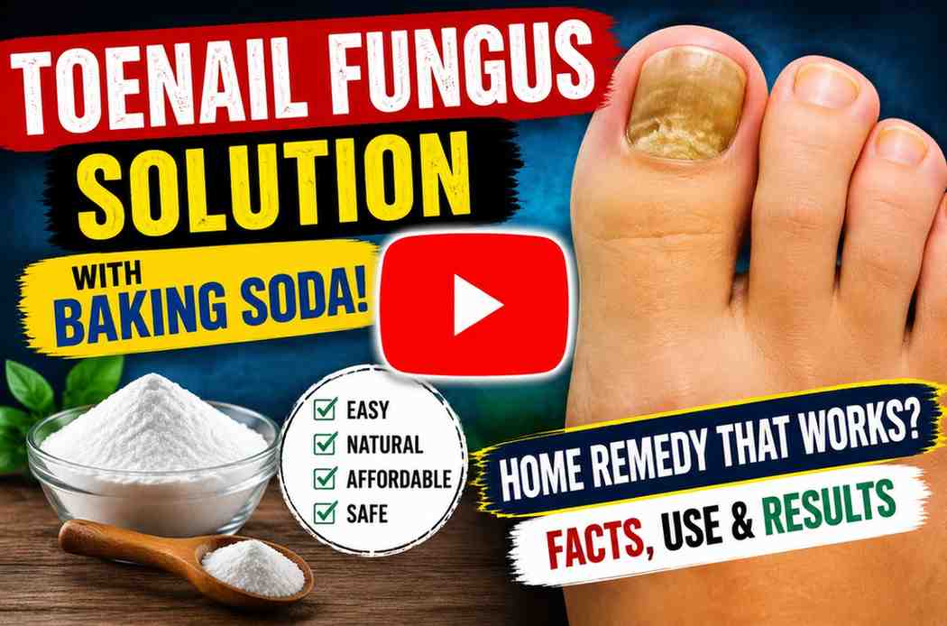 bakingsoda for toenailfungus