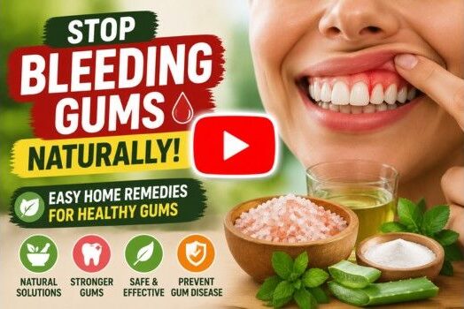 treat bleeding gums naturally