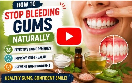 treat bleeding gums naturally