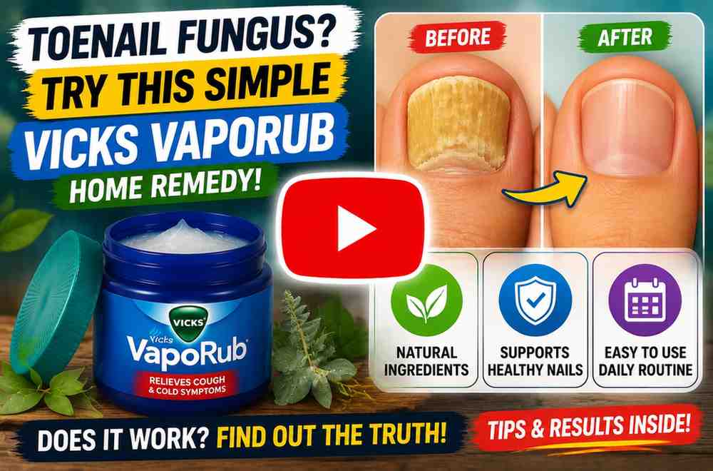 vicksvaporub for toenail fungus