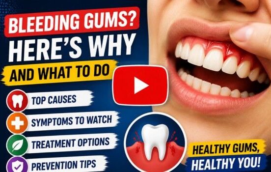 why are my gums bleeding