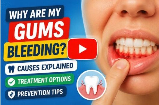 why are my gums bleeding
