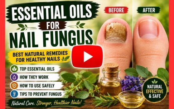 essential oils for nail fungus