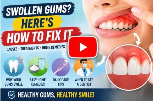 how to treat swollen gums