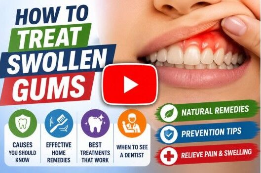 how to treat swollen gums