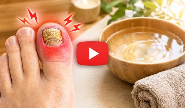 nail fungus pain releif