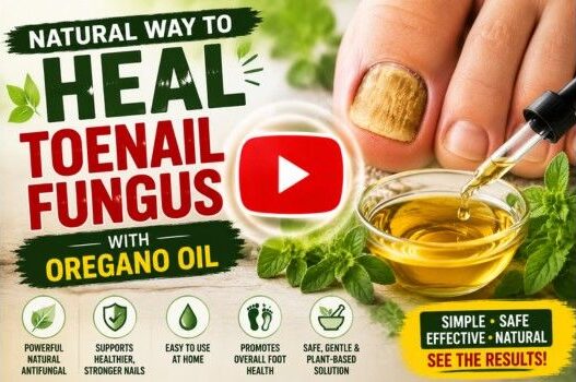 oregano oil for toenail fungus