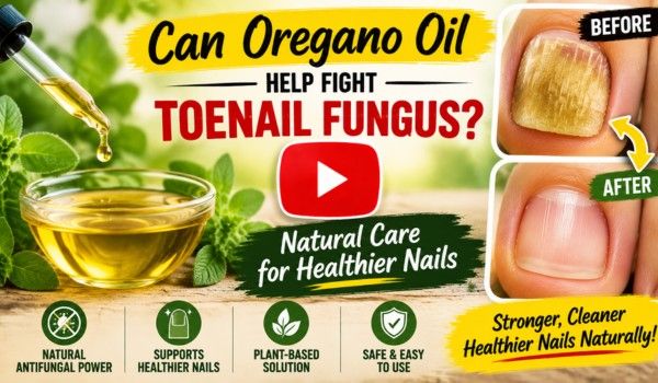 oregano oil for toenail fungus
