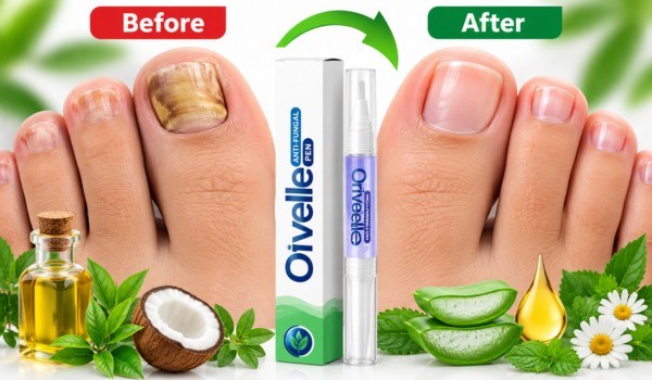 Orivelle Nail Pen before and after